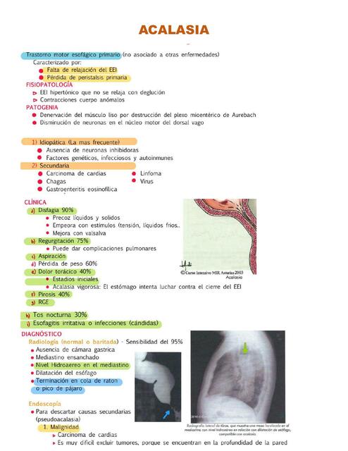 Acalasia 