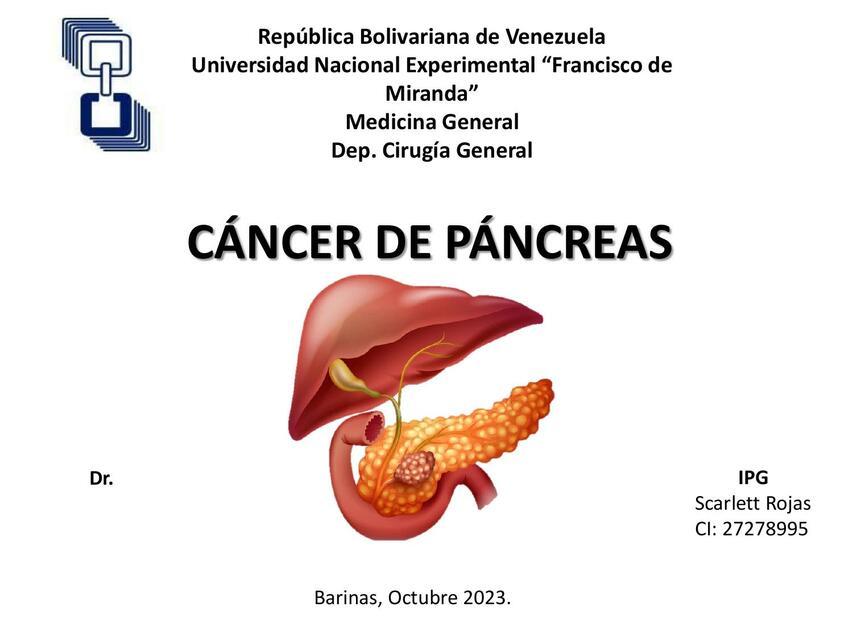 Cáncer de páncreas 