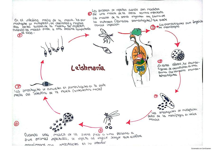 Leishmaniasis