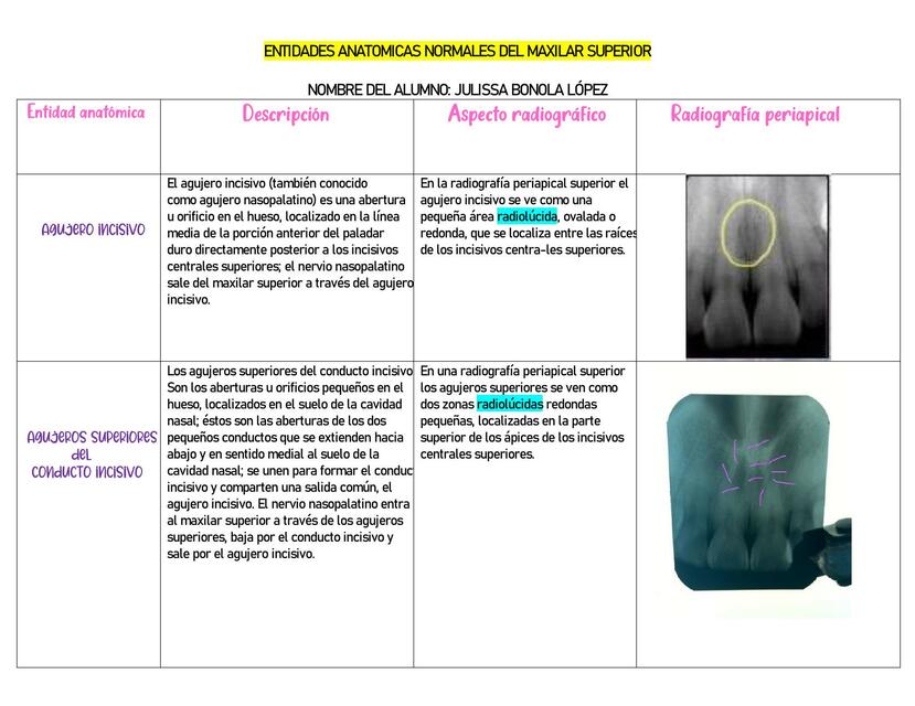 Entidad anatómica del maxilar superios