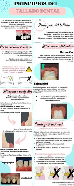 Tallados dentales para prótesis