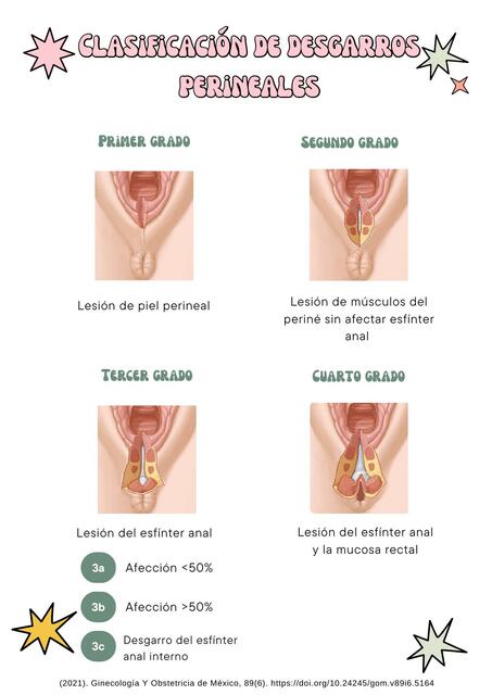 Clasificación de desgarro