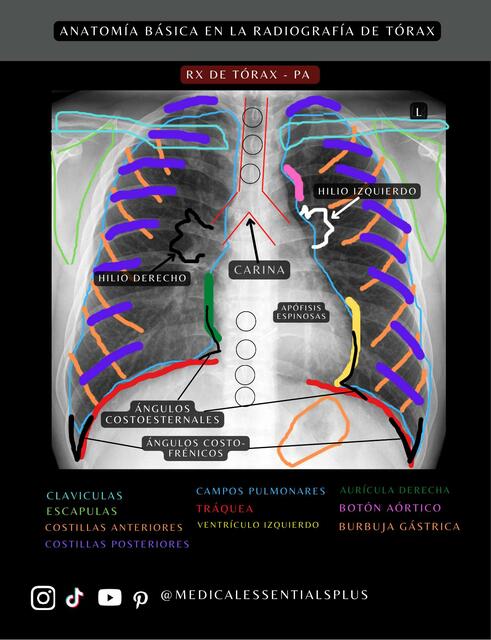 Anatomía Básica en la Radiografía de Tórax