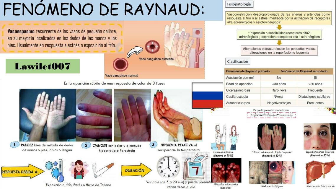 FENÓMENO DE RAYNAUD