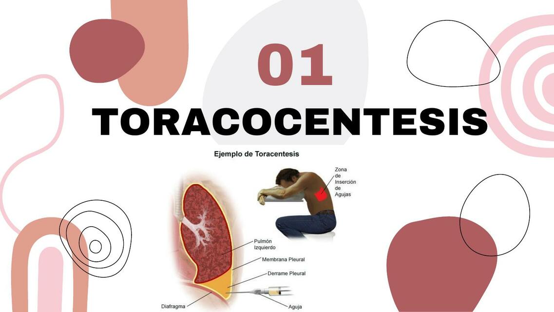 Técnicas Quirúrgicas