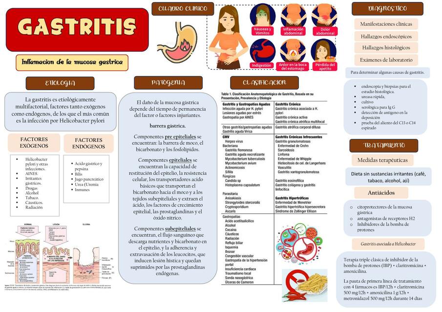 gastritis H