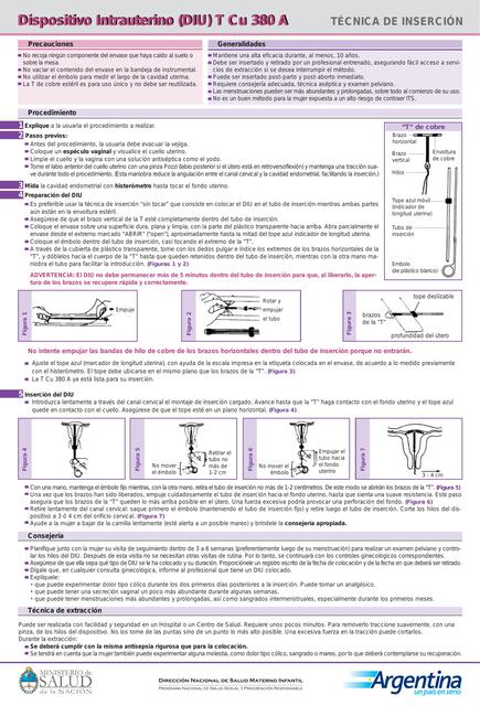 Dispositivo Intrauterino 