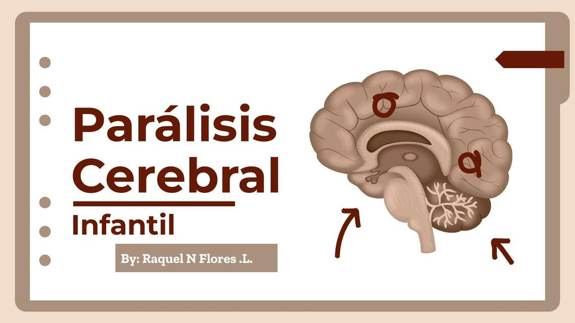 Parálisis cerebrales infantil