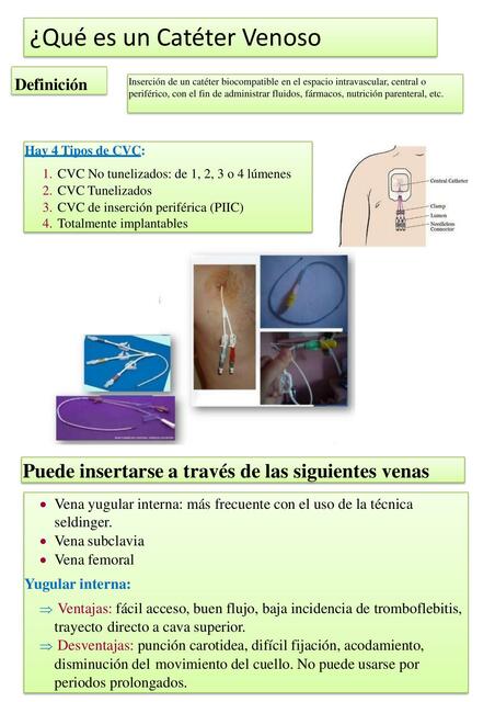 Catéter Venoso Central 