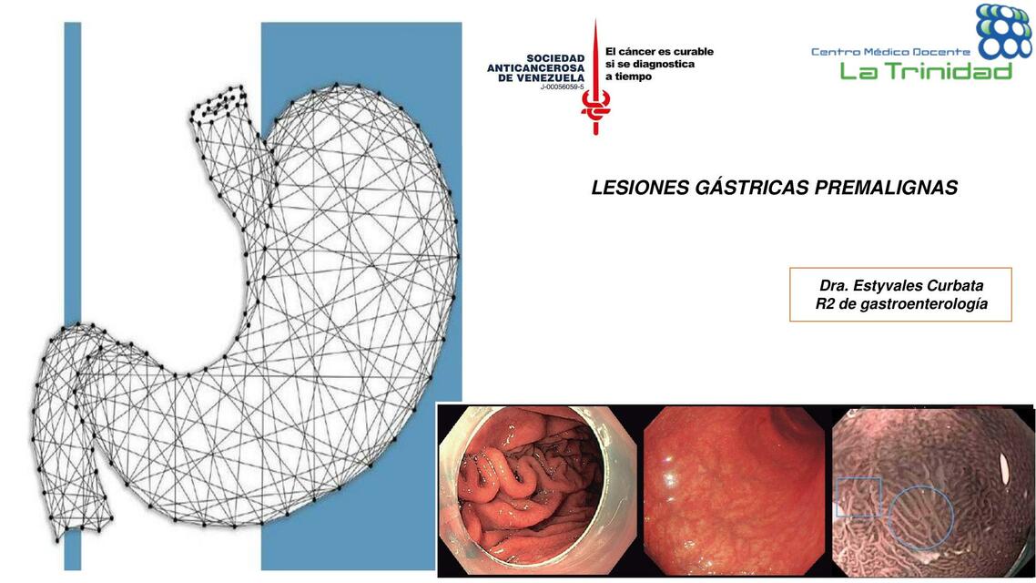 Lesiones gástricas premalignas