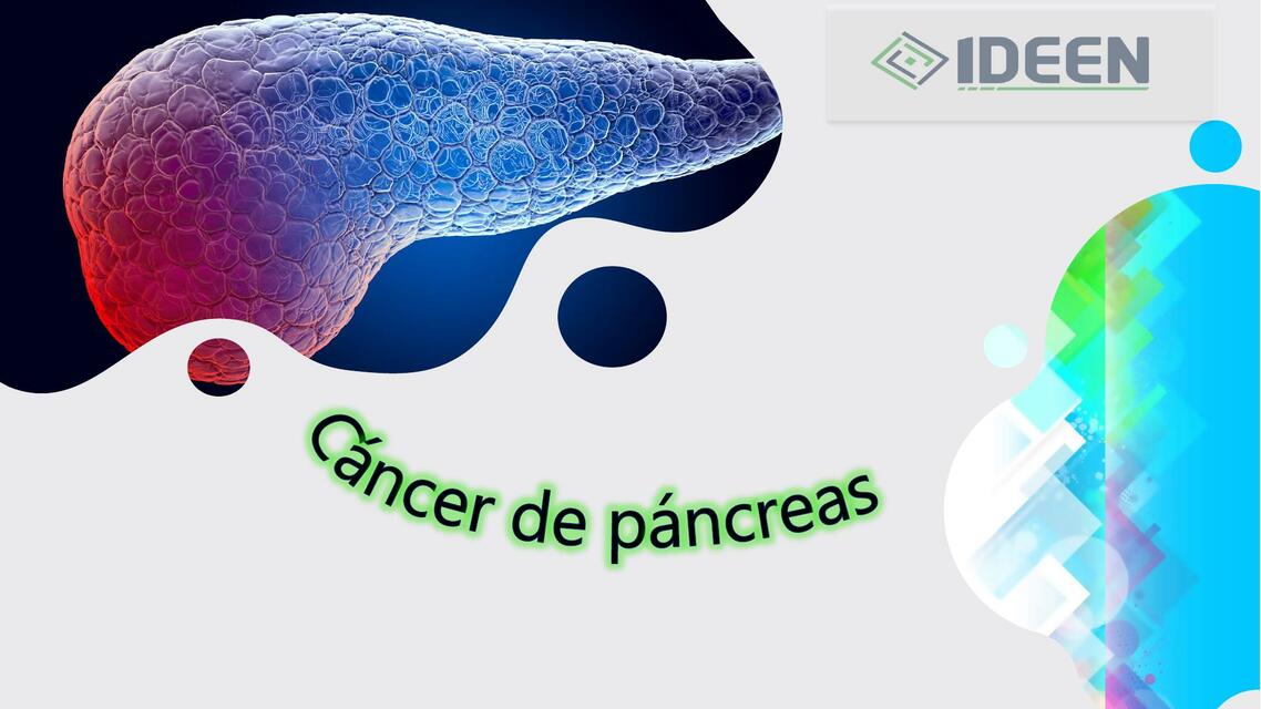 Cáncer de pancreas | Karla guadalupe hernanez diaz | uDocz