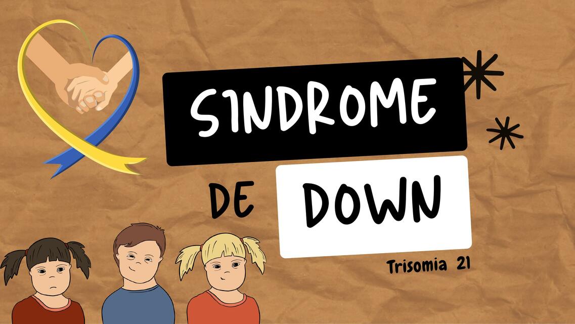 Síndrome de Down 