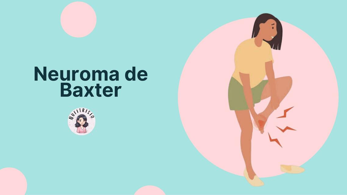 neuroma-de-baxter-nufitrisio-udocz