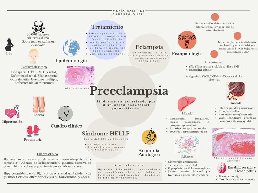 PREECLAMPSIA & ECLAMPSIA Ernesto Ohtli Mejia Ramirez uDocz
