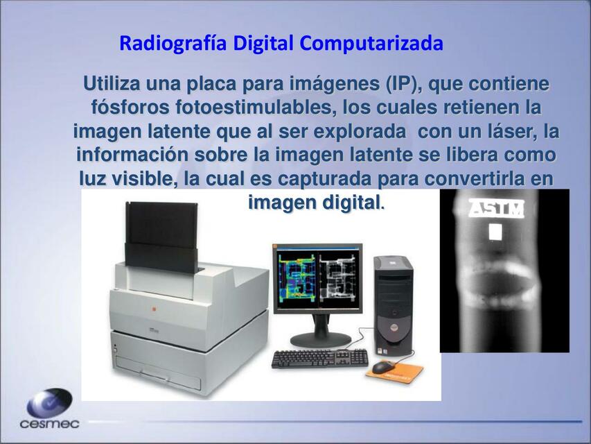 Radiografia Digital Computarizada