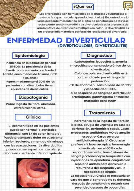 Enfermedad Diverticular