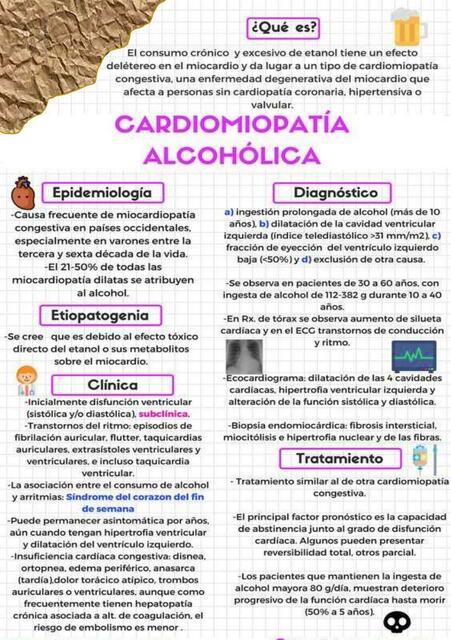 Cardiomiopatía Alcohólica