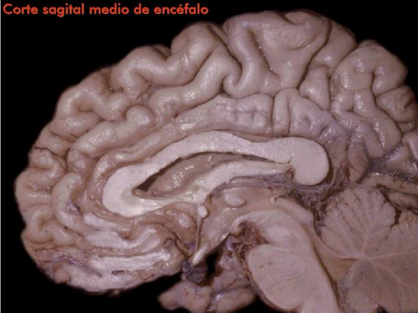 Cortes del Cerebro 