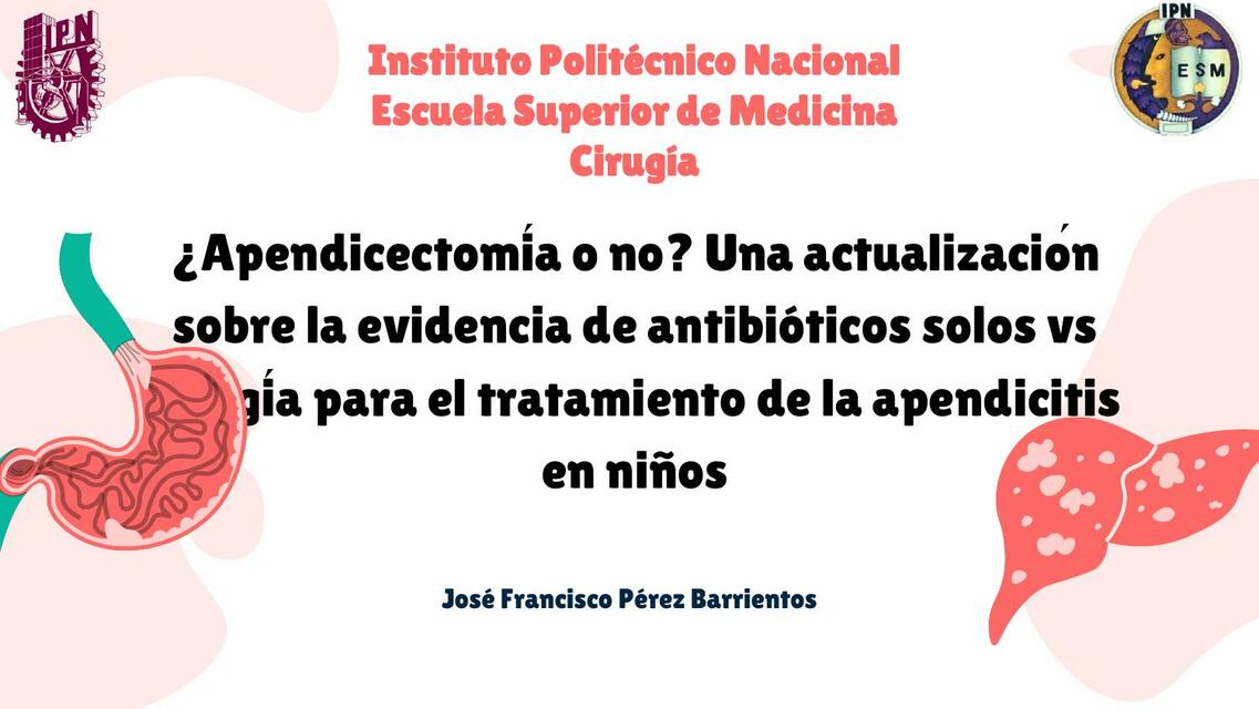 Apendicectomía o No Francisco Pérez uDocz