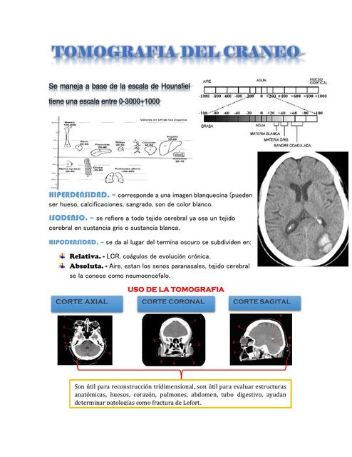 4 TOMOGRAFIA DEL CRANEO