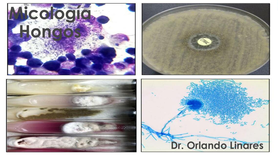 Candida albicans