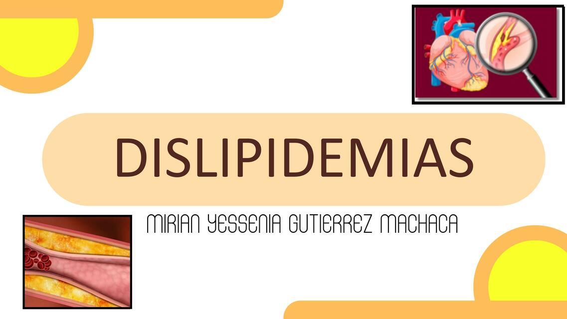 Dislipidemias 