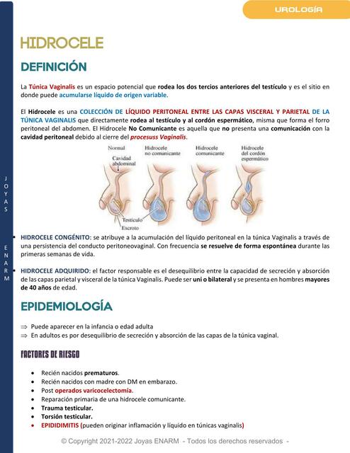 Hidrocele