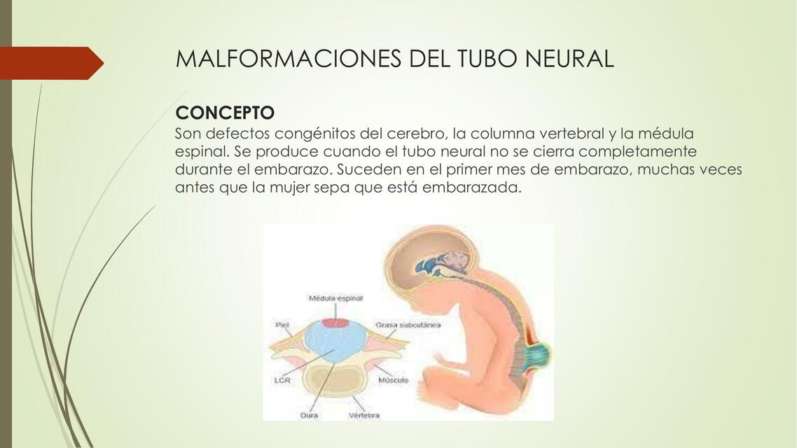 MALFORMACIONES DEL TUBO NEURAL