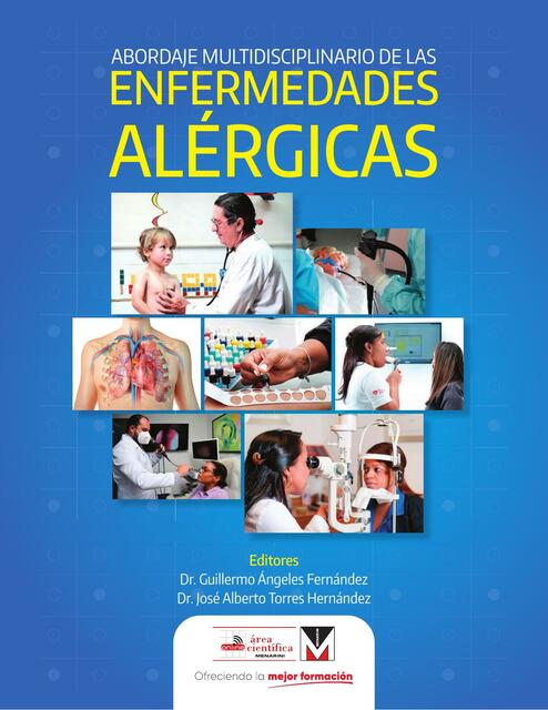 Abordaje multidisciplinario de las enfermedad alergicas 