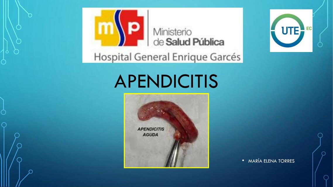 Apendicitis 