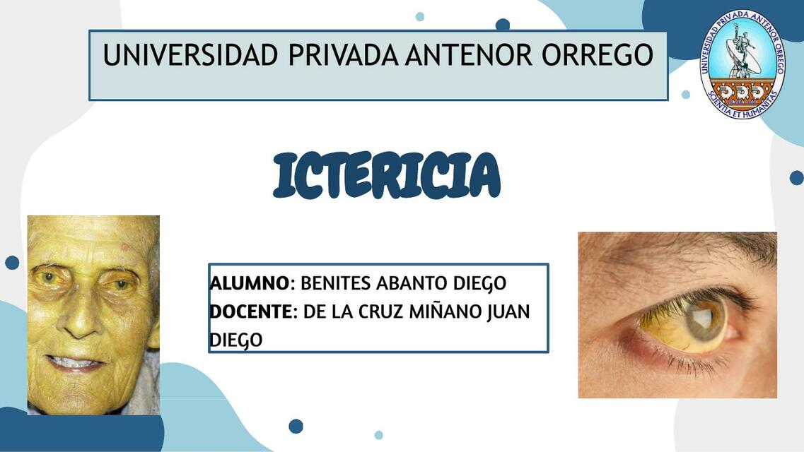 Ictericia 