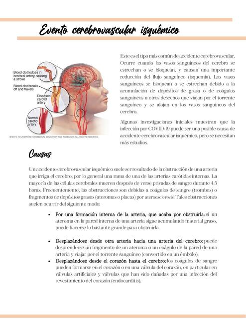 CEREBROVASCULAR ISQUEMIA Y HEMORRAGIA