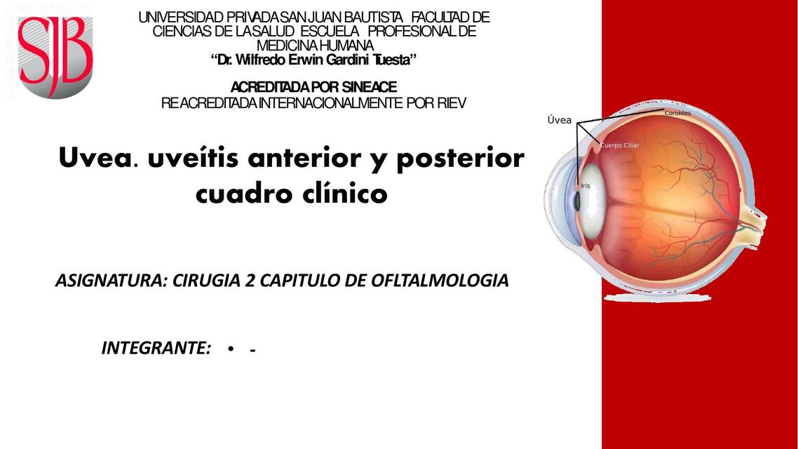 Uvea. Uveítis Anterior y Posterior 