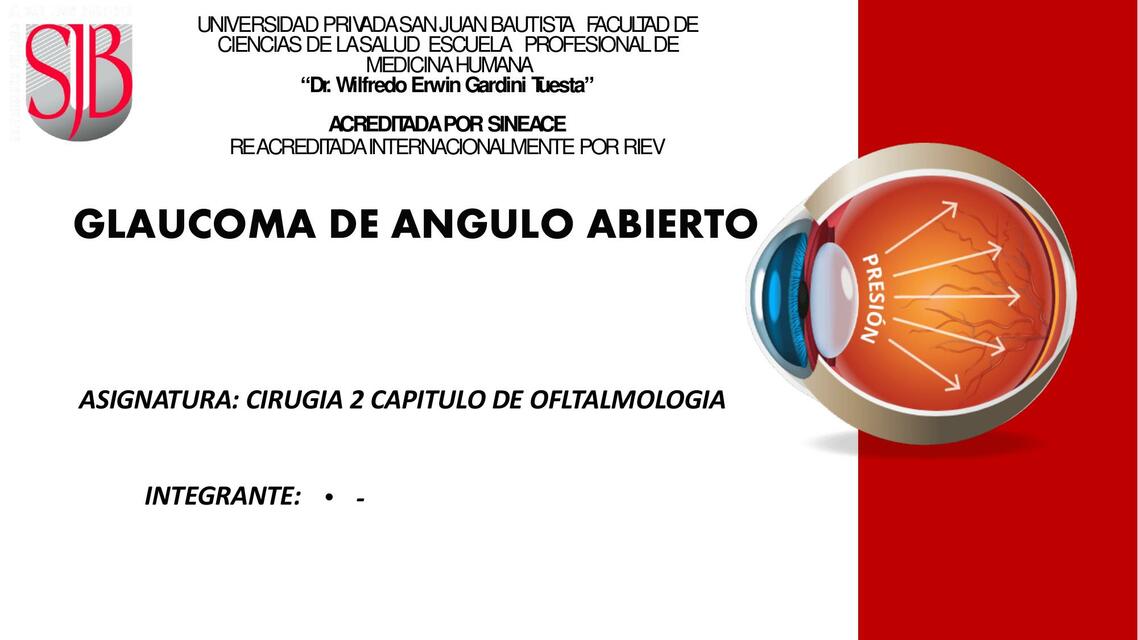 Glaucoma de Ángulo Abierto 