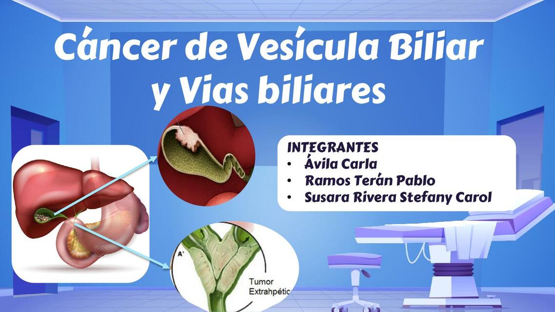 cáncer de las vías biliares