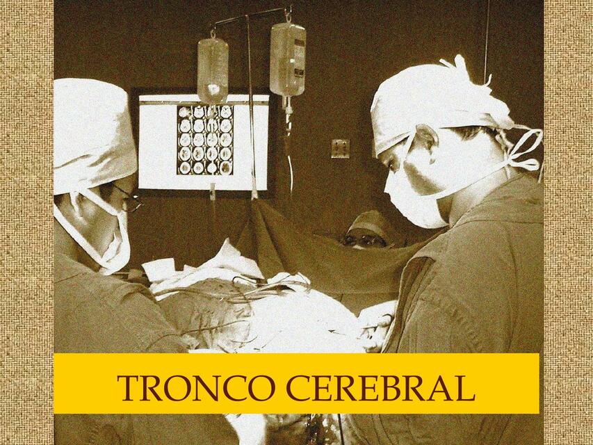 Tronco cerebral