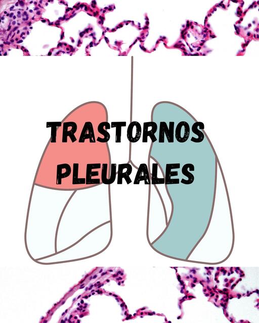 Trastornos Pleurales