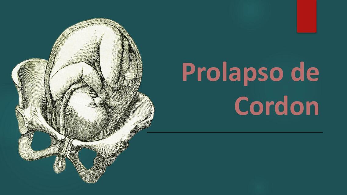Prolapso de Cordon Escuela medica uDocz