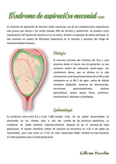 Aspiracion de meconio