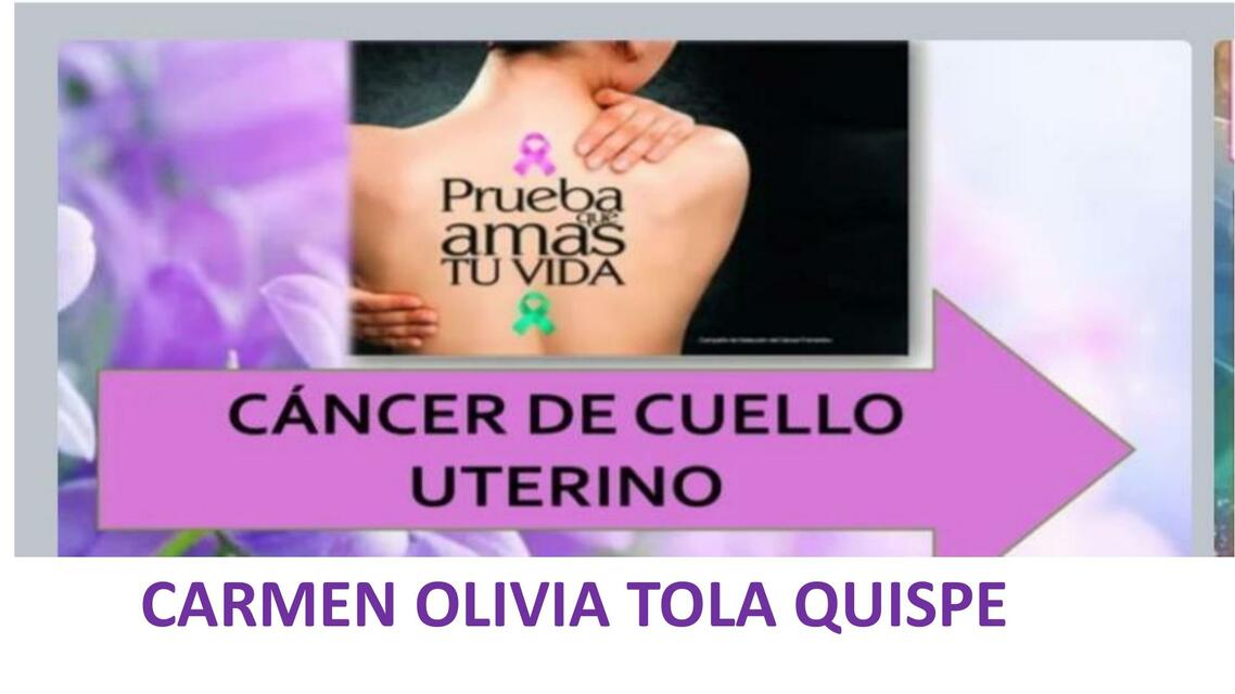 Cáncer de Cuello Uterino 