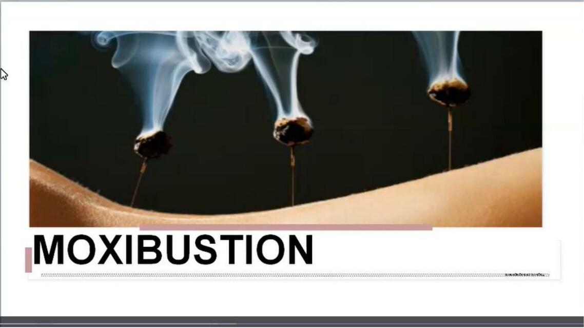 Moxibustion 