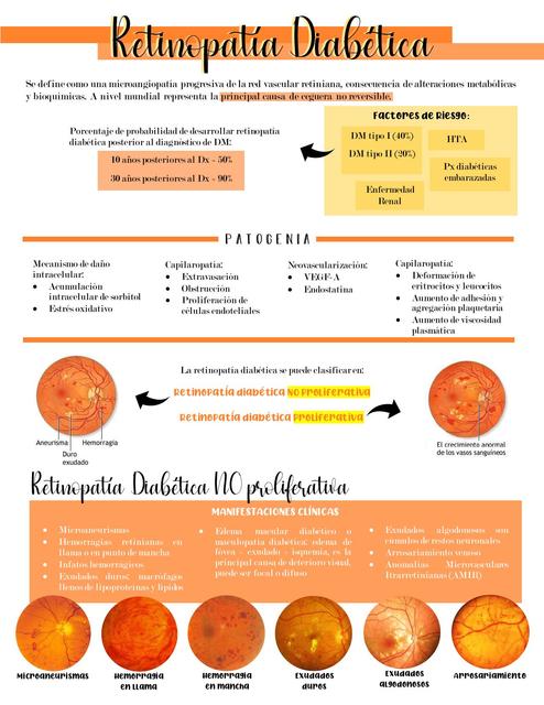 RETINOPATÍA DIABETICA resumen