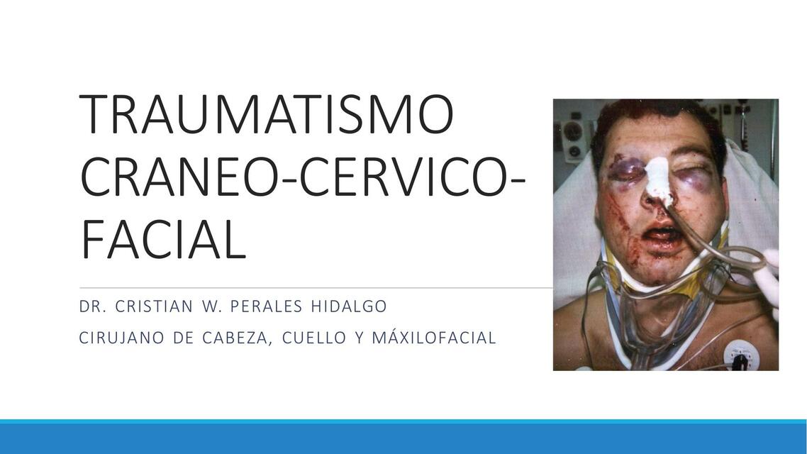 03 TRAUMATISMO CRANEO CERVICO FACIAL