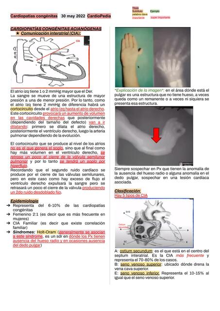 3 Cardiopatías congenitas acianógenas 2