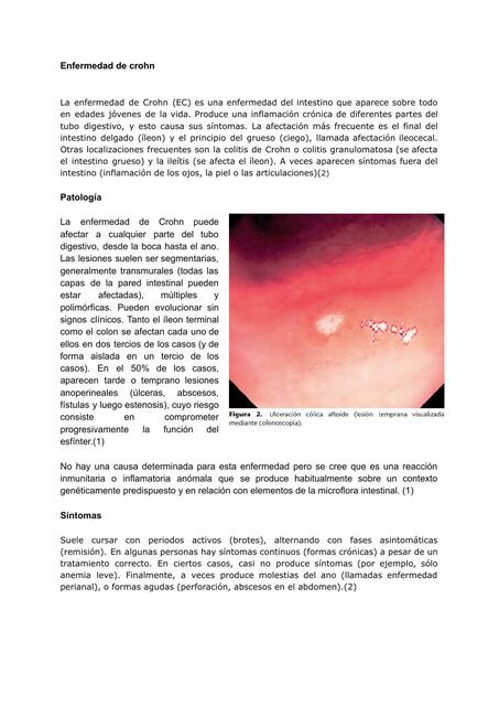 enfermedad de crohn y colitis ulcerosa