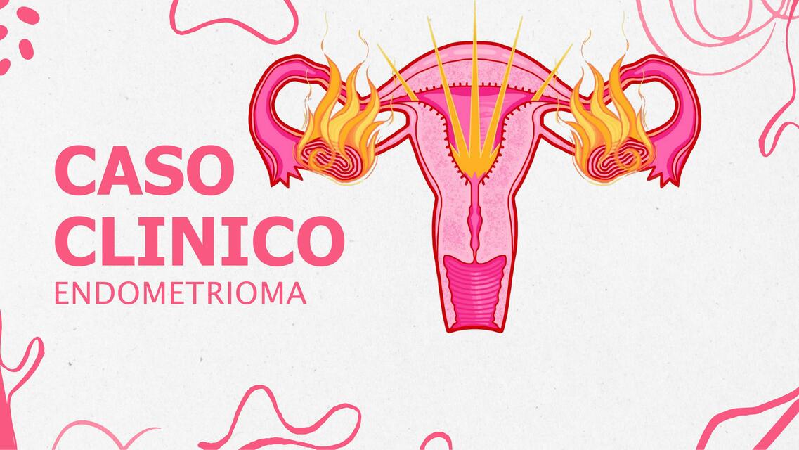 CASO CLINICO ENDOMETRIOMA