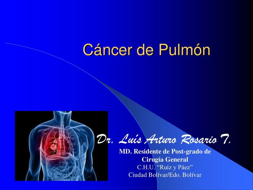 Cáncer de Pulmón 