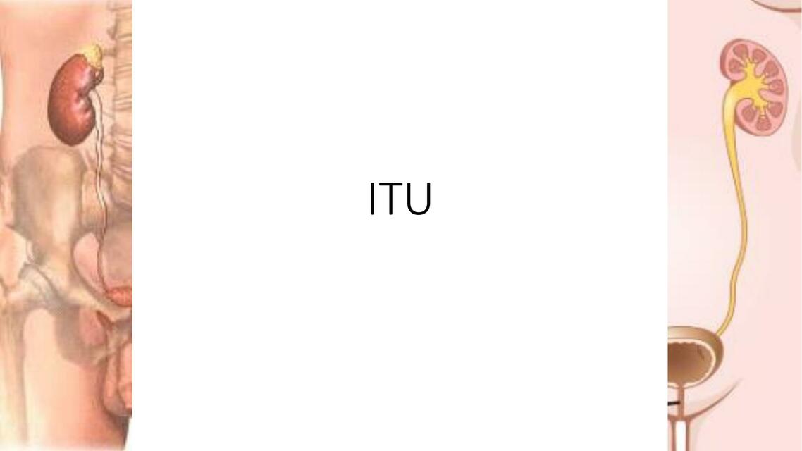 ITU