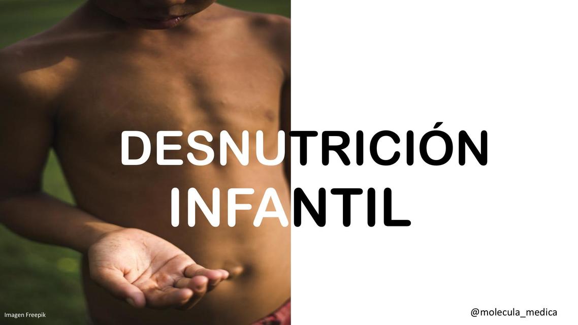 DESNUTRICIÓN INFANTIL