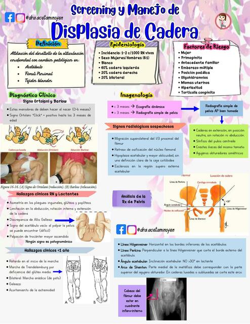 Screening y Manejo de Displasia de Cadera